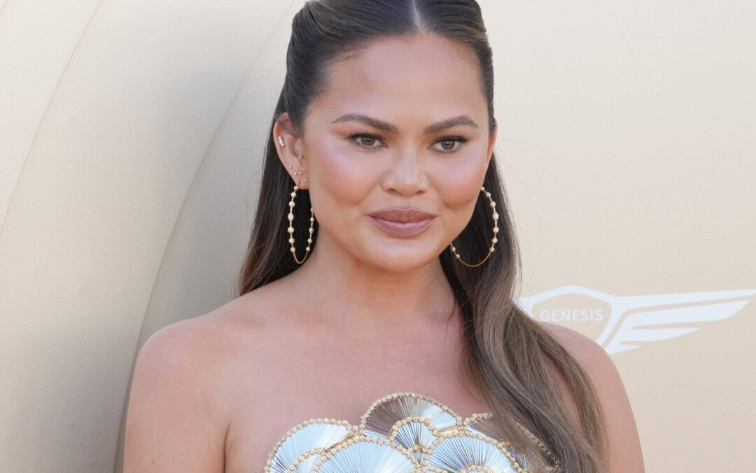 Chrissy Teigen’s cosmetic surgery update signals a new Hollywood trend