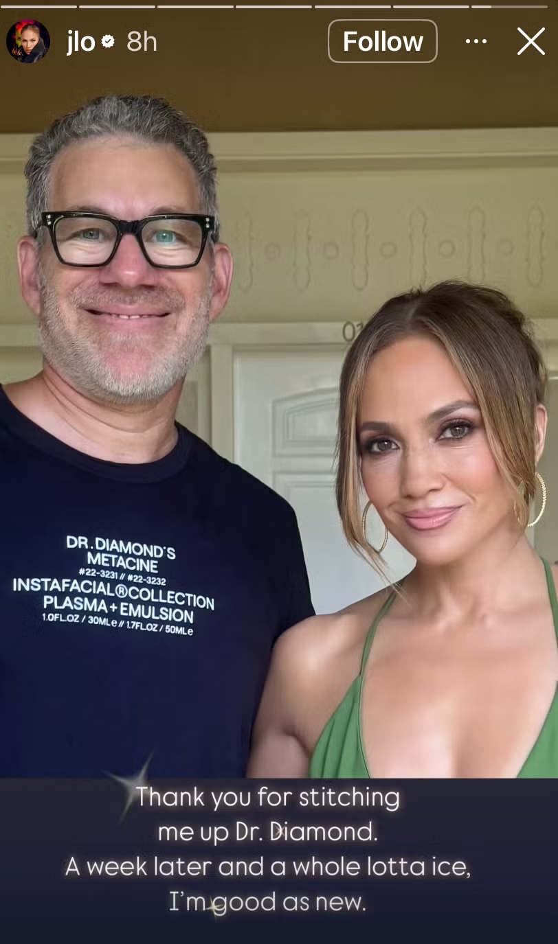 img-7723-png-68248a71e31e7 J Lo
